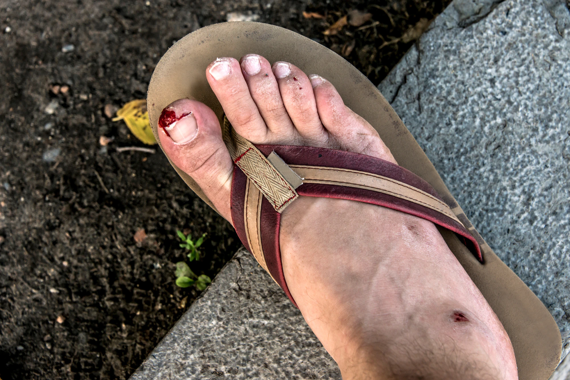 Flip on sale flop toe