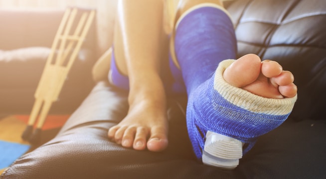 Leg crack treatment online