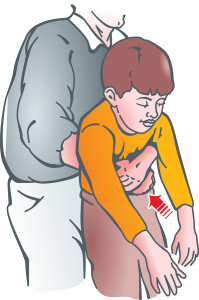 Heimlich manuever on a child