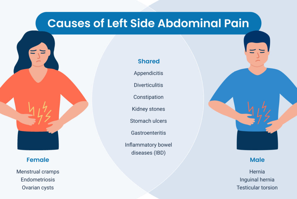 Diagram of causes of male and female abdominal pain.
