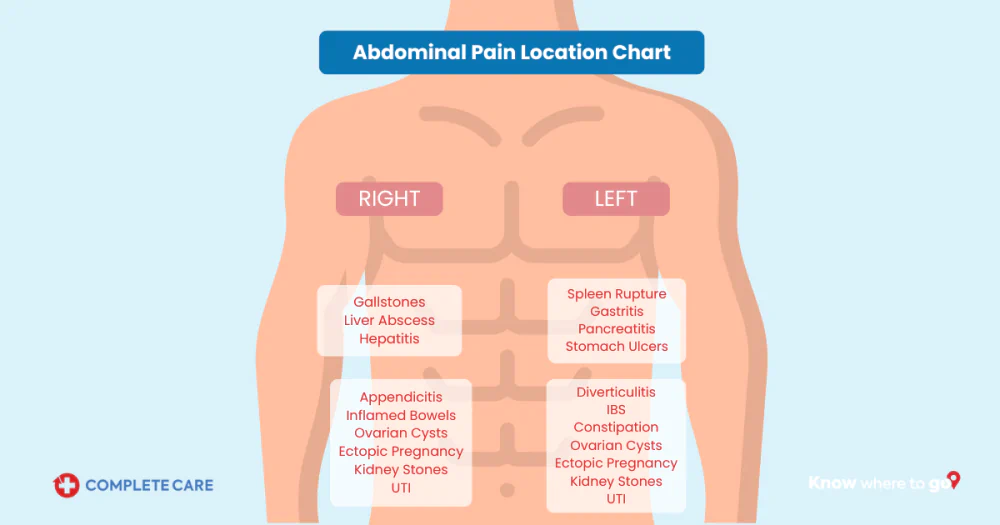 Complete Care infographic about abdominal pain location meanings