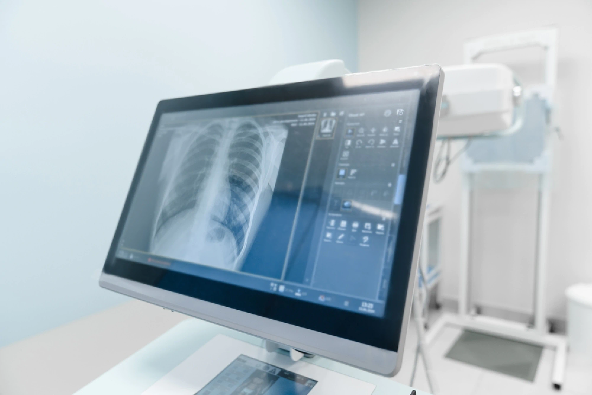 Emergency X-Rays From Complete Care